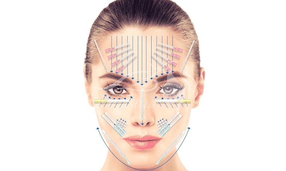 facial threading position