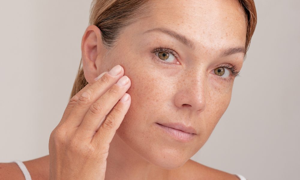 Laser Treatments for Pigmentation on Face