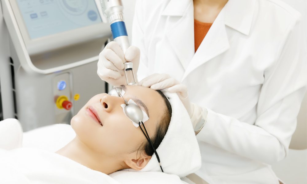 Laser Treatments for Pigmentation on Face