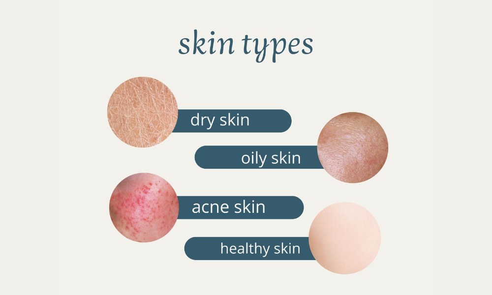 types of the skin