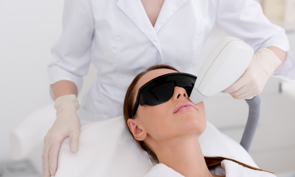 laser hair removal on face