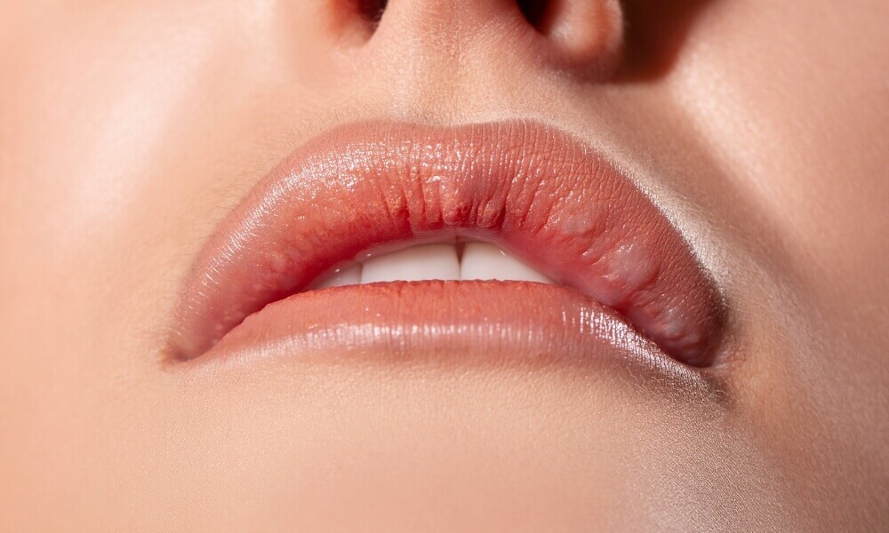 side effect of lip filler injection