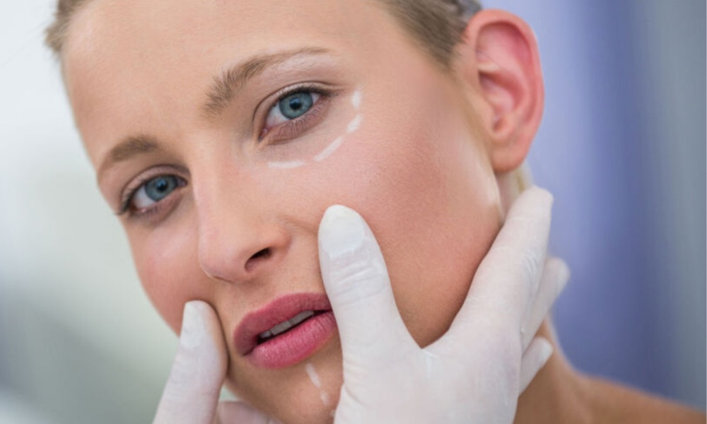 Preparation for Thread Facelift Procedure