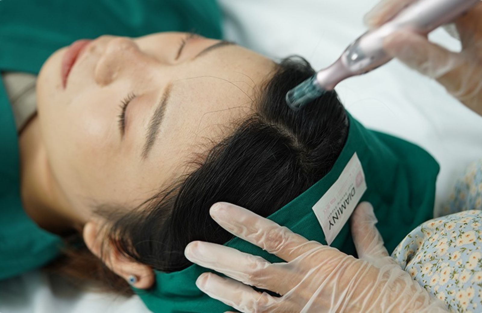 Diaminy Derma Pen for Hair