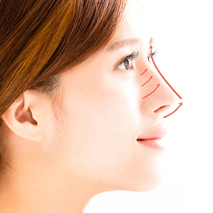 PCL Nose Thread Lift