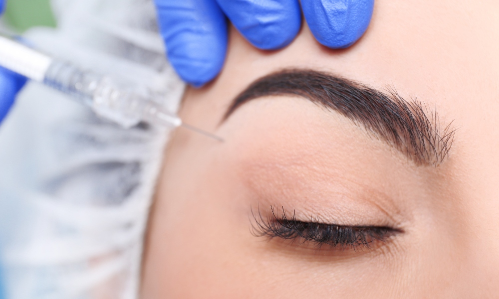 brow lift filler injection