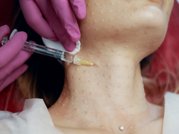 Diaminy Meso Needle for Neck Injection