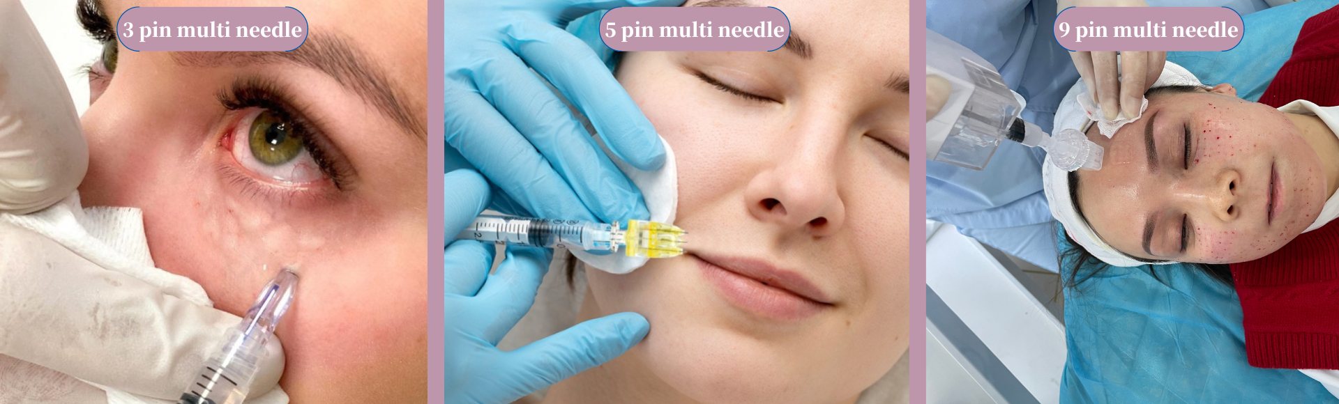 Diaminy multi injector needle used for mesotherapy