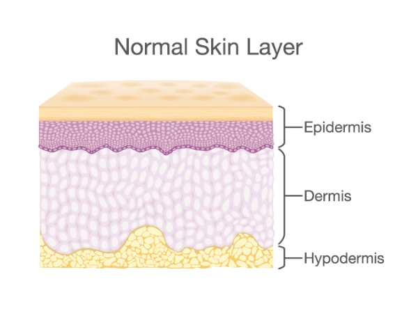 Mesotherapy treatment skin layer