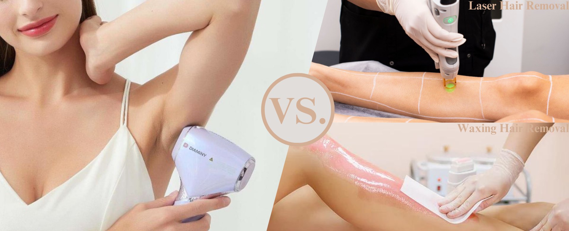 diaminy ipl hair removal vs Laser hair removel vs waxing hair removel