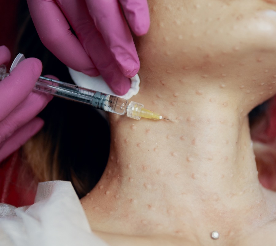 Diaminy meso needle