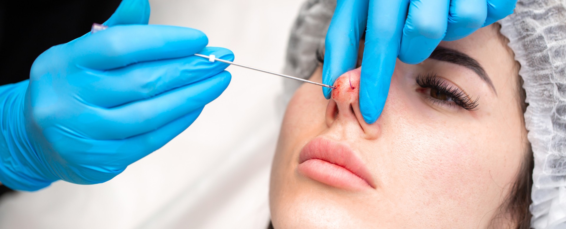 nose threads