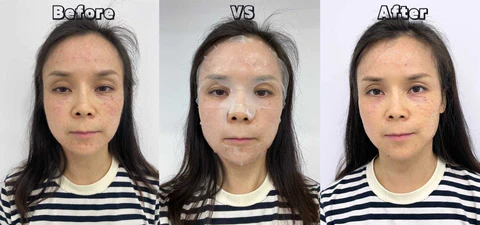 Liquid Dressing Repair Facial Mask Dr. Olsen before and after