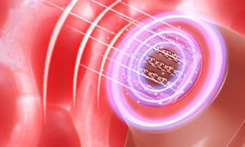 RF Dot Matrix Device