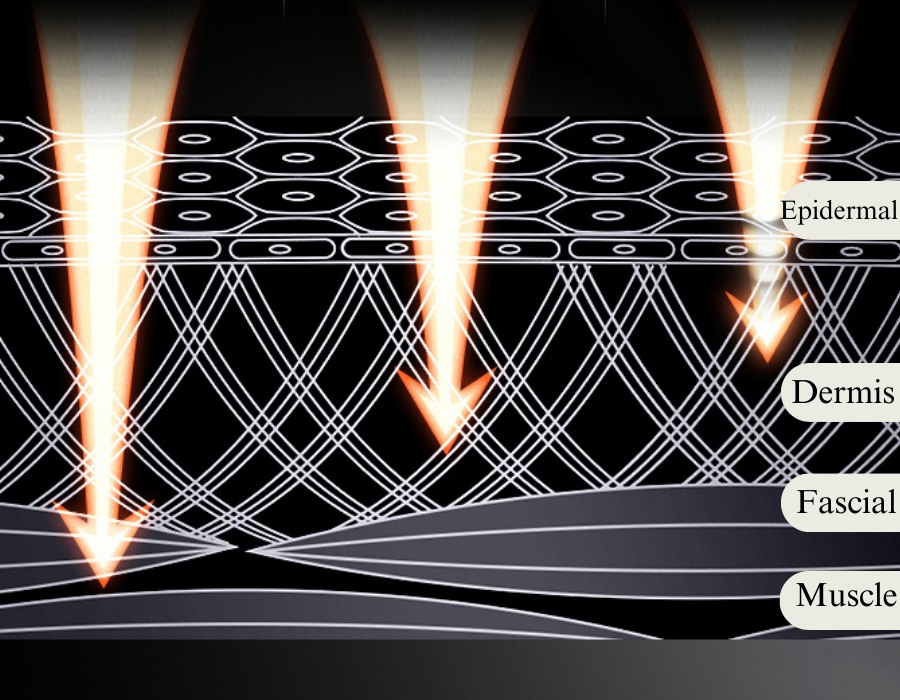 RF Dot Matrix Device