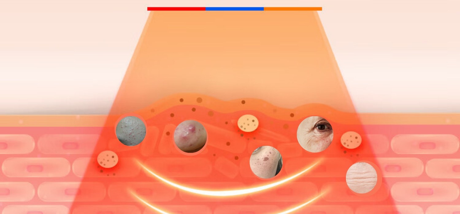 diaminy led face mask