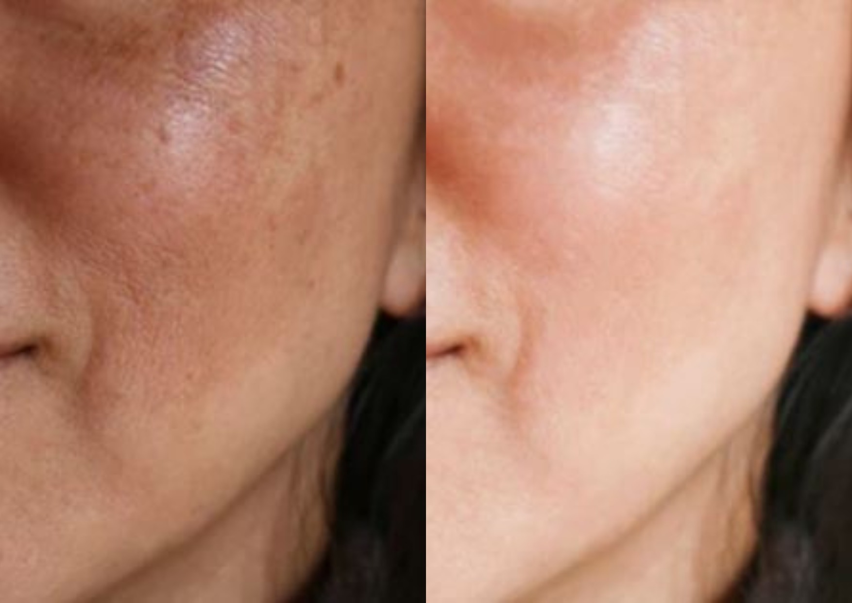 Yellow light whitening: diaminy led face mask before and after