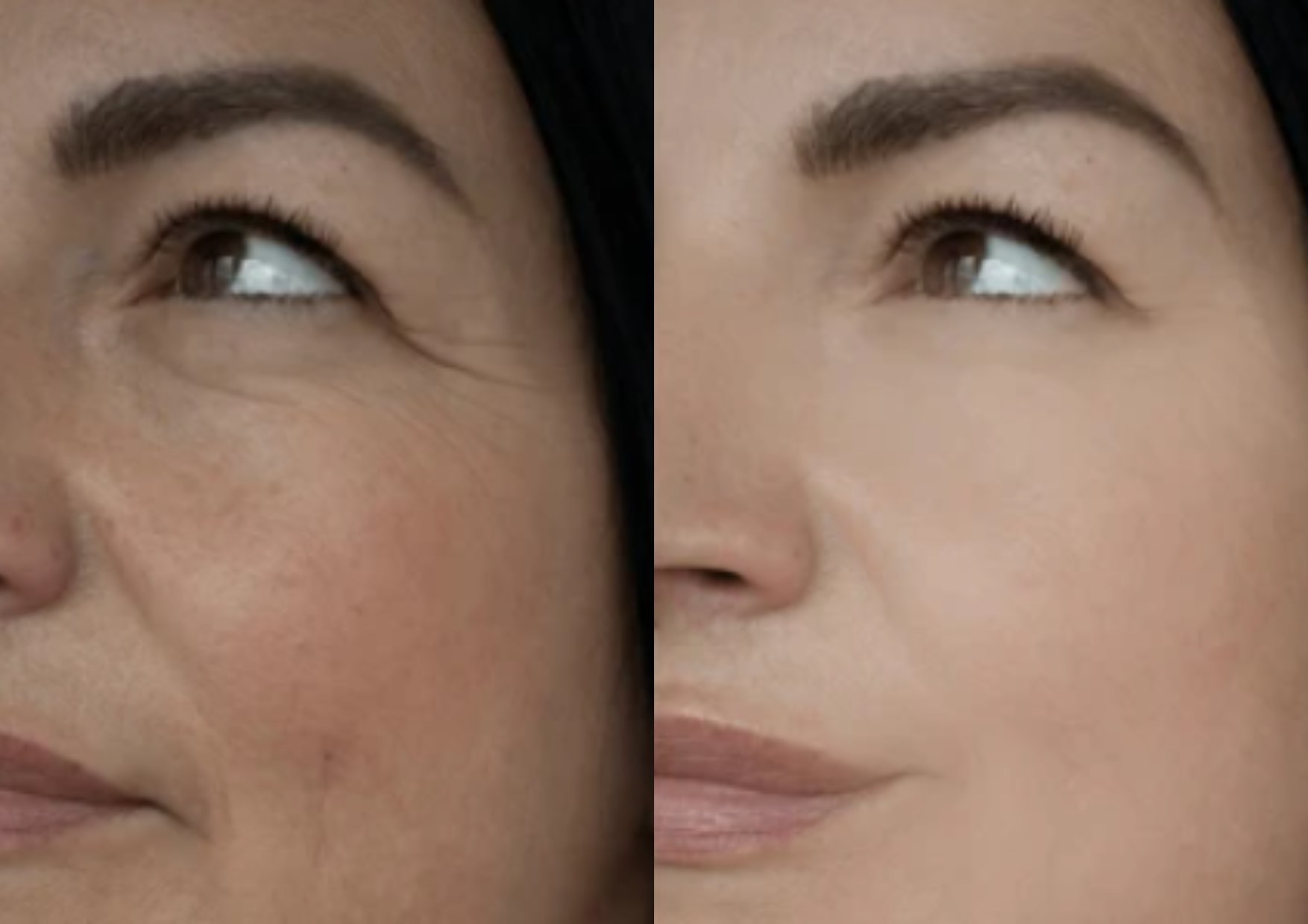 Red light wrinkle removal: diaminy led face mask before and after