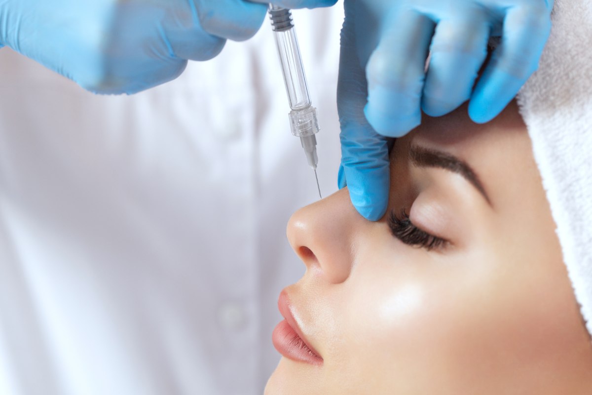 nose filler injection
