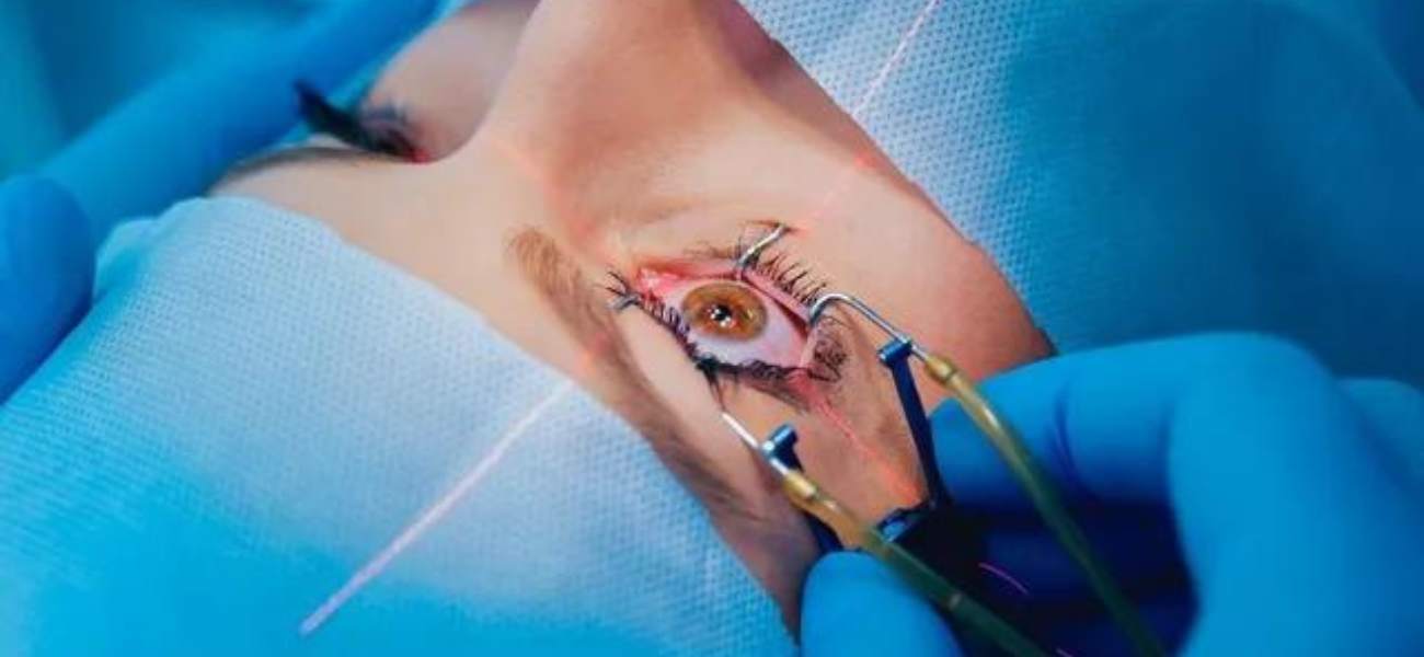 Cataract Surgery