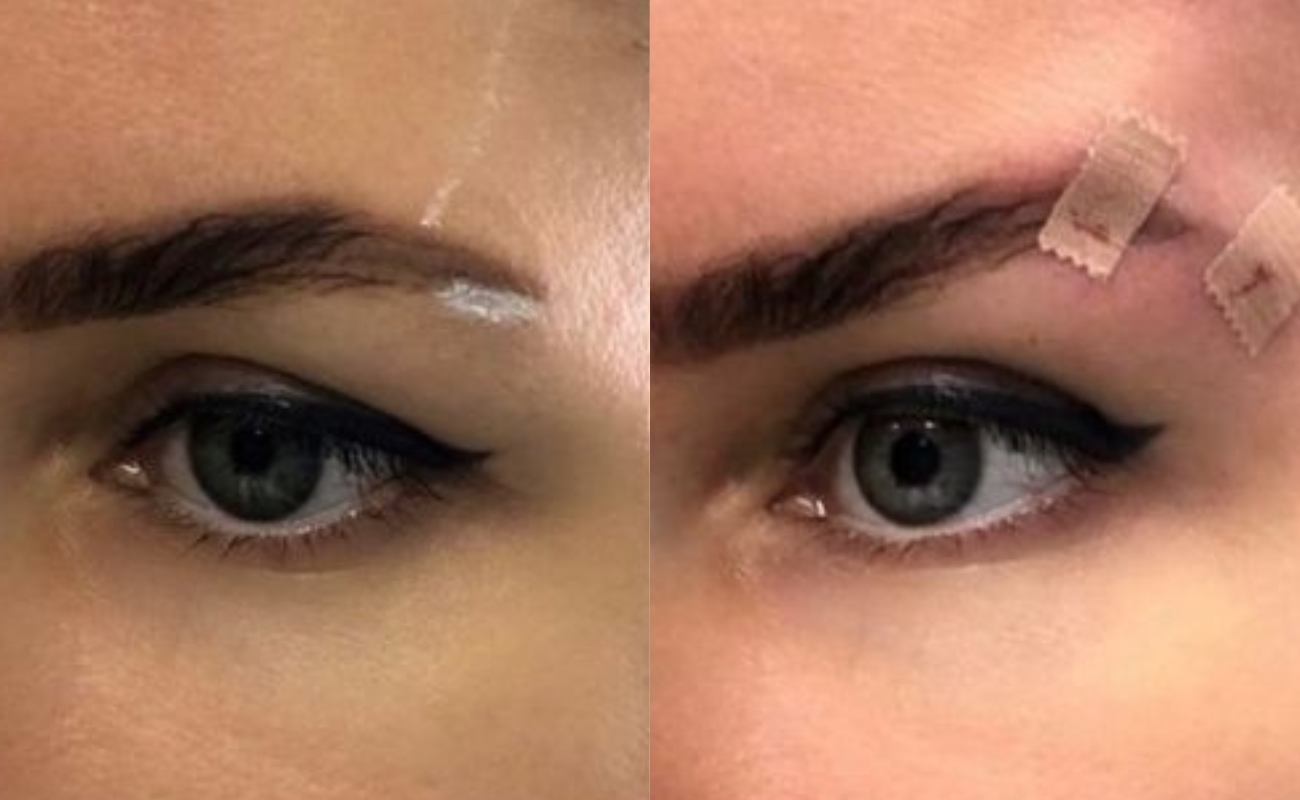 Molding Cog Threads Before And After Comparison