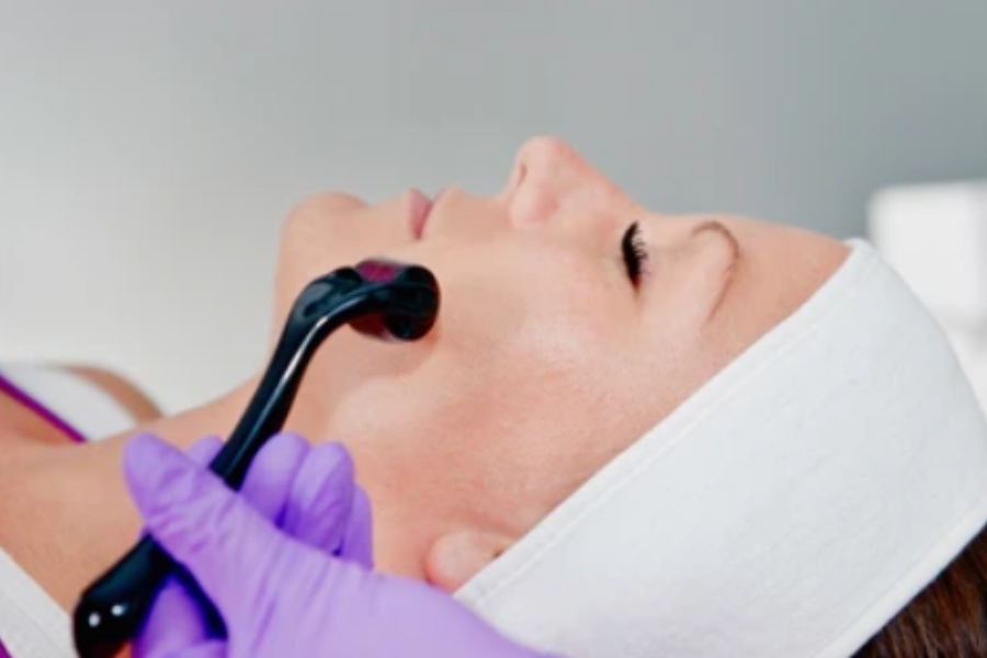 What Do Derma Rollers Work
