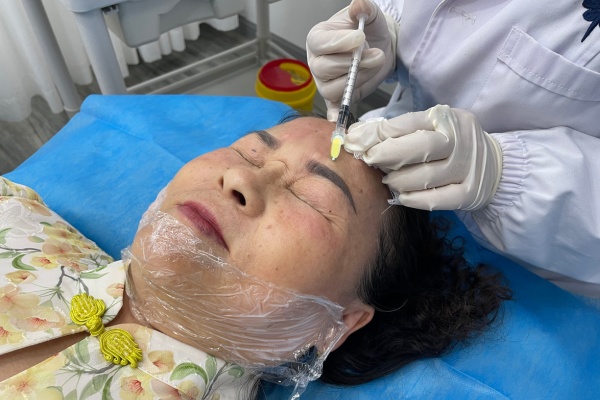 Botox injection with 30G meso needle