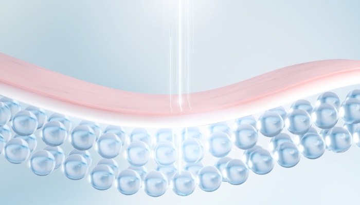 Diaminy How does Dermapen for Stretch Marks work