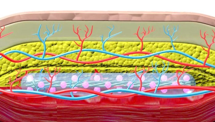 Diaminy How does Dermapen for Stretch Marks work