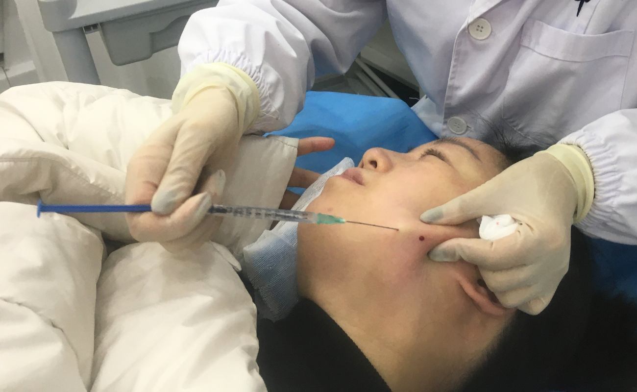 How to Use Duckbill Cannula