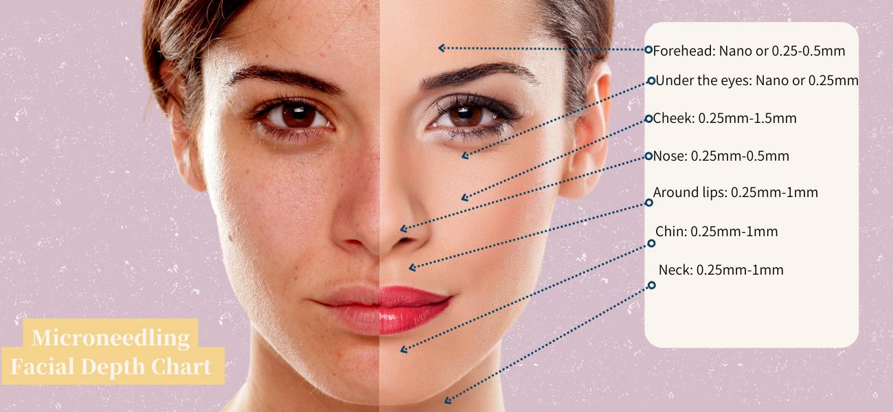 Microneedling facial depth chart