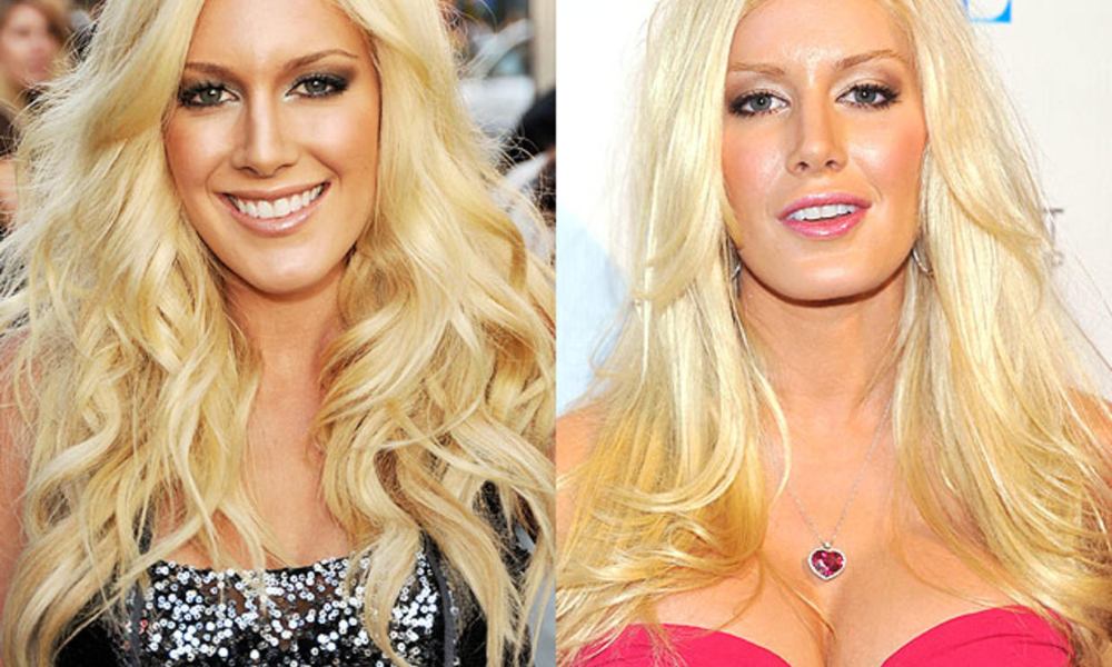 3. Heidi Montag