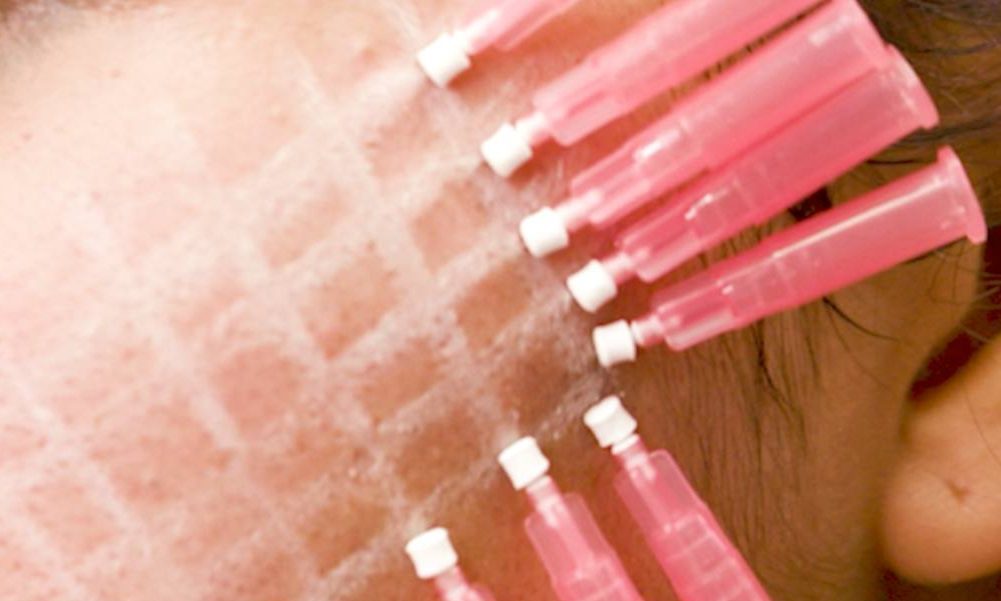 how to prevent thread lift pucker how to prevent thread lift pucker