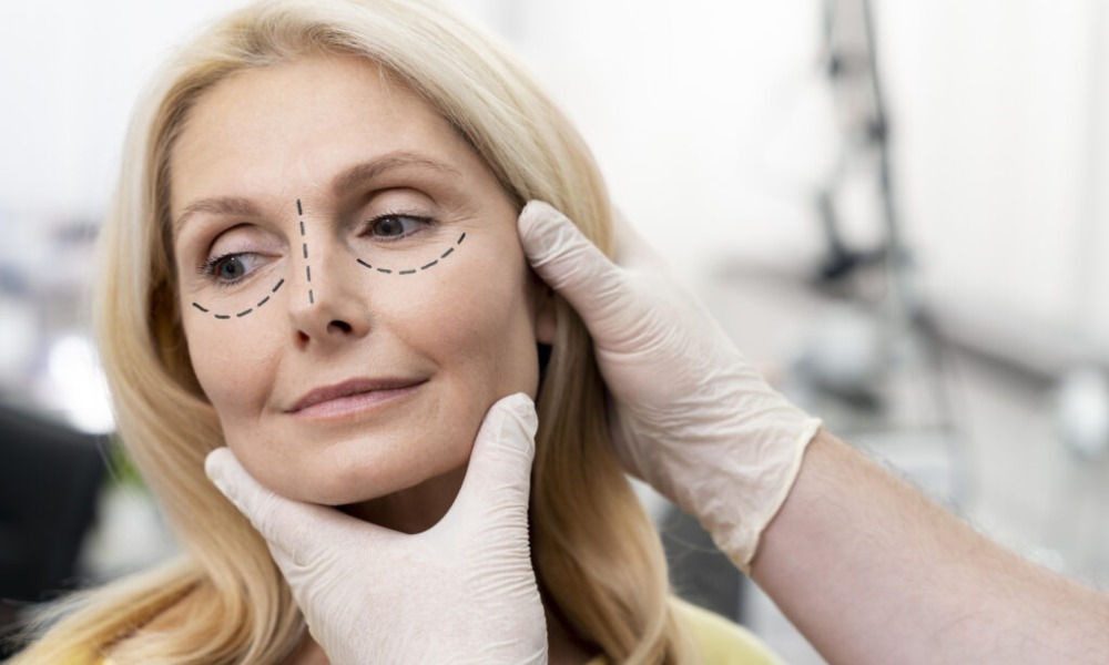 Upkeep and Follow-Up after facelift procedure