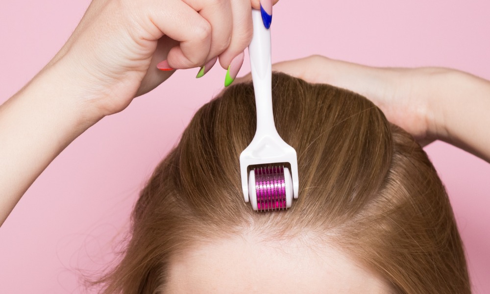 derma roller for hair loss