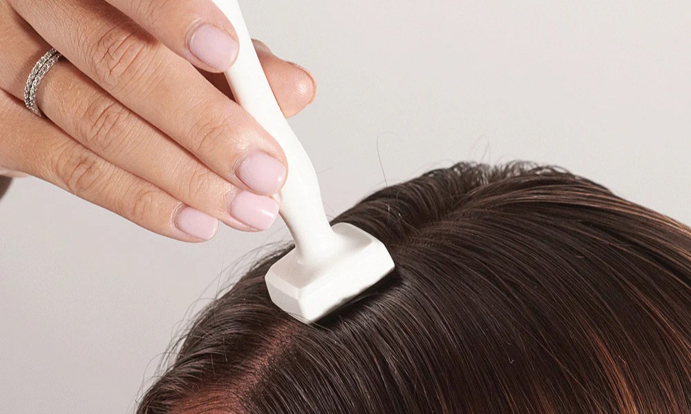 derma roller for hair loss